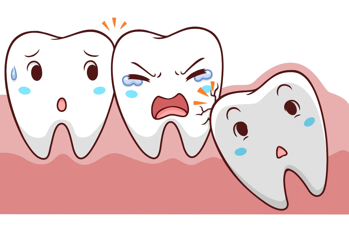 Wisdom Tooth Removal Treatment Sinhagad Road Pune